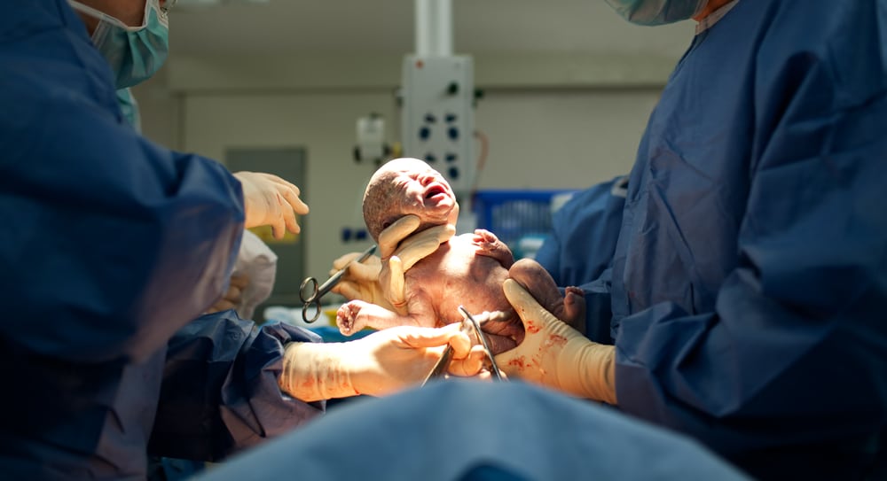 April Is Cesarean Awareness Month: Understanding C-Section and its Impacts in 2023